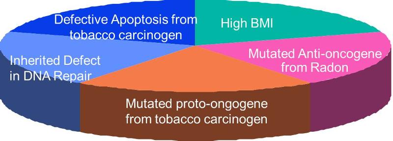 A component cause model for cancer: High body mass index, mutated anti-ongogene frin radon, mutated proto-oncogene from tobacco carcinogen, inherited defect in DNA repair, defective apoptosis from tobacco carcinogen,