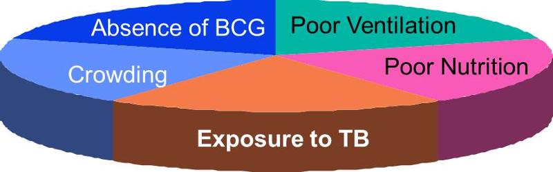 Possible component causes of a case of TB consisting of absence of exposure to TB, BCG vaccine, poor ventilation, poor nutrition,, and crowdin,