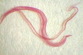 Schistosoma.png