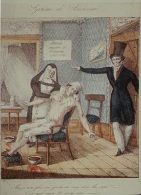Engraving of Dr. Broussais directing a nurse-nun to continue applying leeches to bleed a man who is suffering from cholera. The man appears ghastly white.