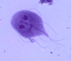 http://www.swvhreno.com/blog/2012/05/24/giardia-parasitic-protozoa/
